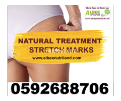 STRETCH MARK PRODUCTS IN GHANA - 2