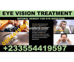 NATURAL TREATMENT FOR CATARACT