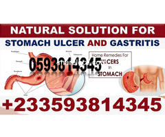 NATURAL REMEDY FOR STOMACH ULCER IN GHANA