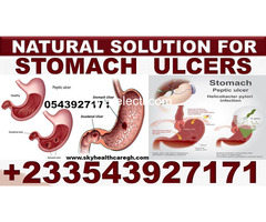 NATURAL ANTIBIOTICS FOR STOMACH ULCER IN GHANA - 5