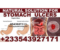 NATURAL SUPPLEMENT ROR STOMACH ULCER IN GHANA - 4