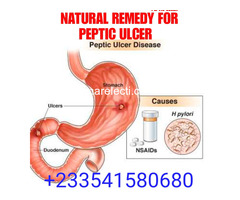 REMEDY FOR PEPTIC ULCER IN GHANA